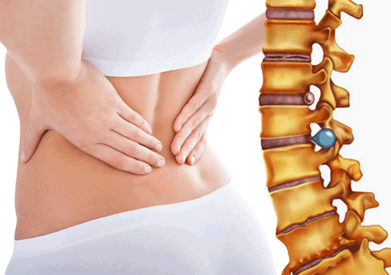 Đèn tần phổ sóng điện từ điều trị thoát vị đĩa đệm hiệu quả cao